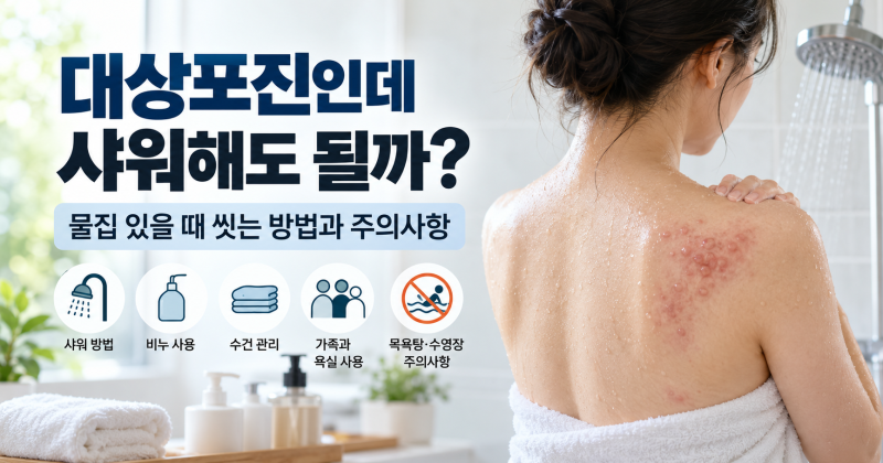 대상포진인데 샤워해도 될까? 물집 있을 때 씻는 방법과 주의사항