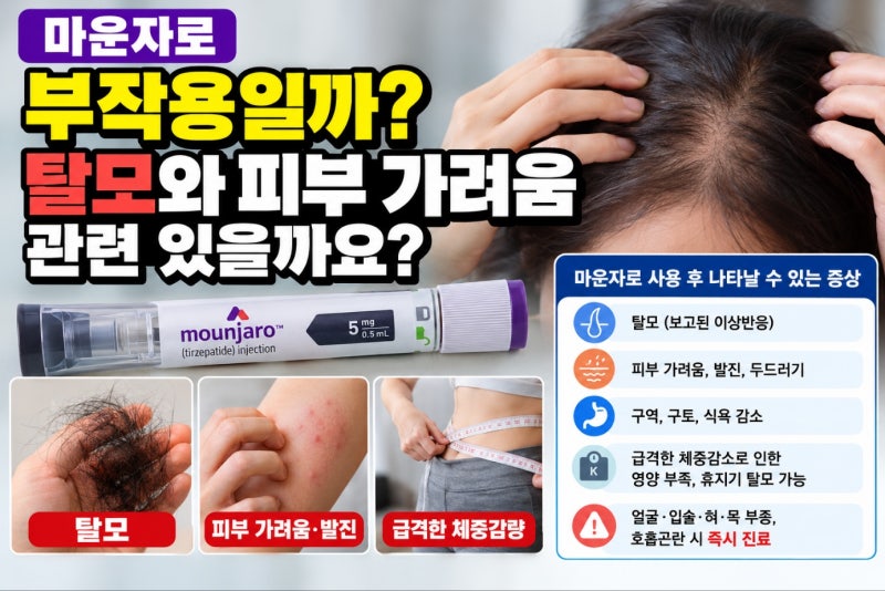 마운자로 부작용, 탈모와 피부 가려움도 관련이 있을까요?
