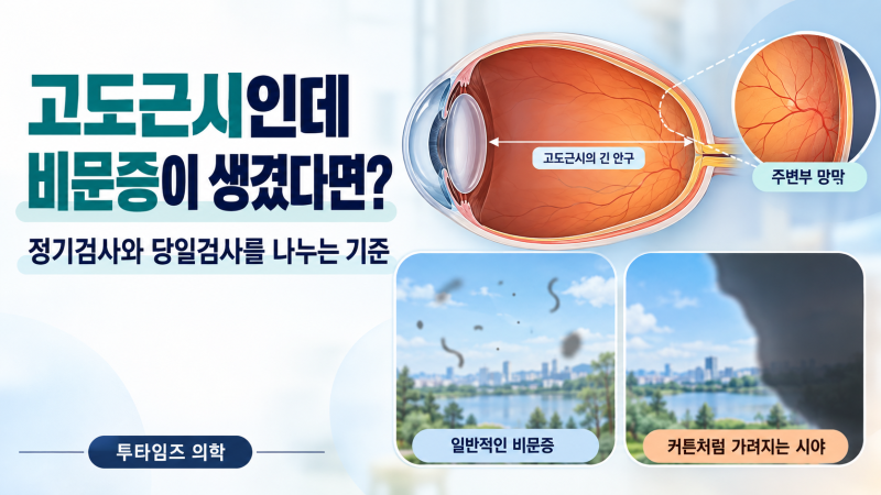 고도근시인데 비문증이 생겼다면? 망막열공·망막박리 검사 시점