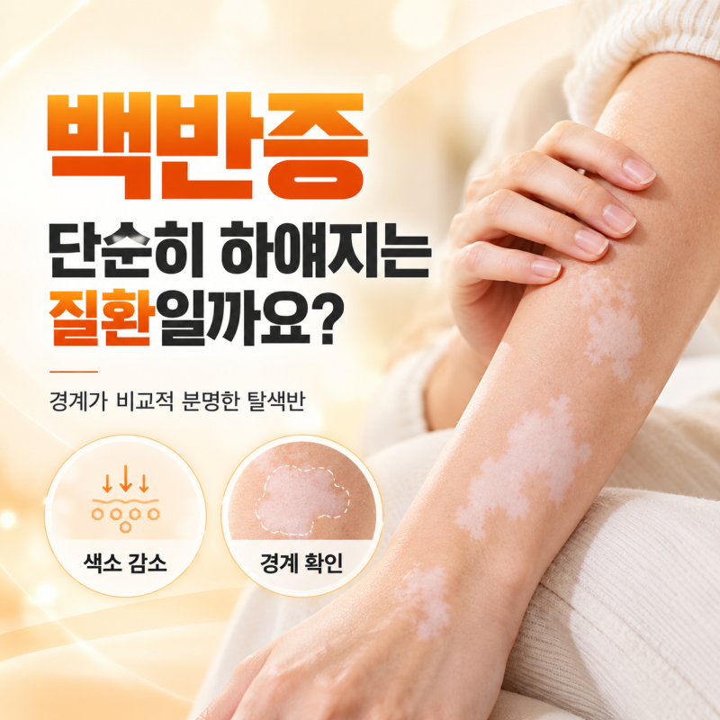 노원피부과 하얀반점, 백반증 치료 전 저색소증과 먼저 구분해야 합니다