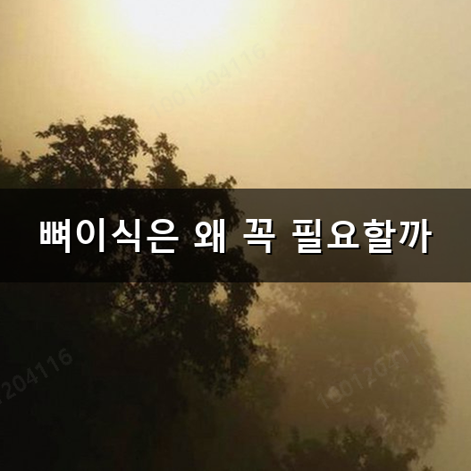 임플란트 뼈이식 비용 생각보다 왜 이렇게 많이 들까?
