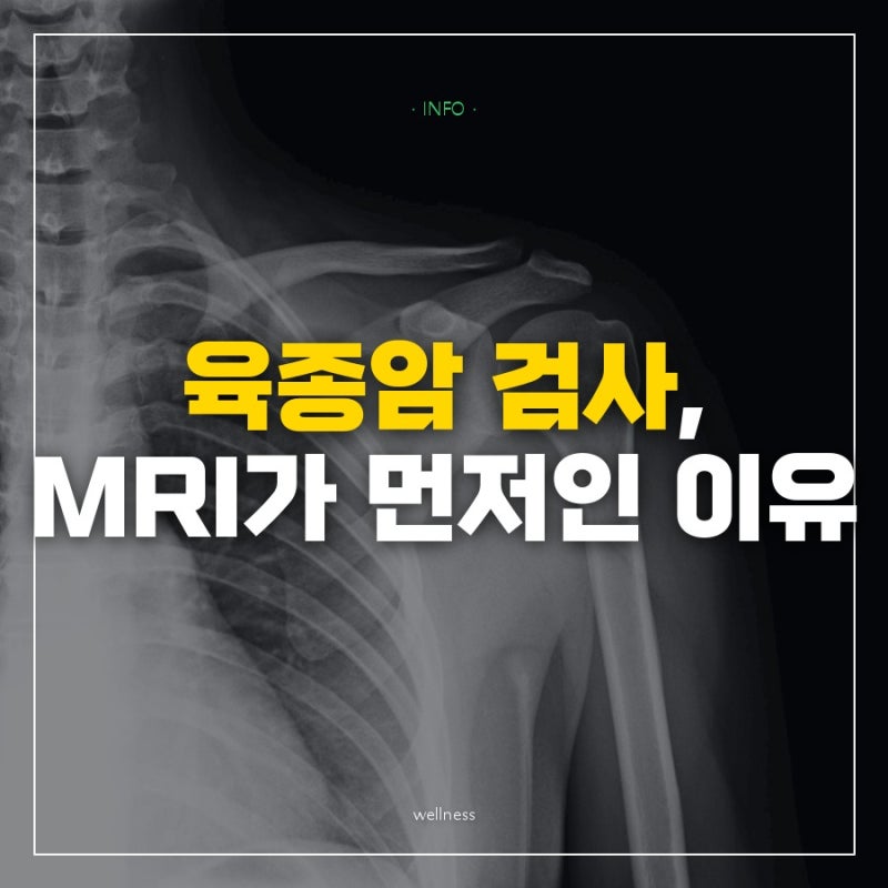 "육종암 검사는 조직검사부터인 줄 알았는데" MRI를 먼저 찍는 이유와 폐 전이가 잘 가는 자리