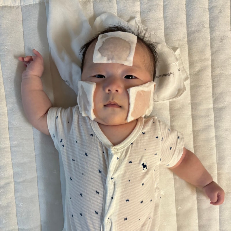신생아 태열 극복 후기:: 수딩젤로 더 심해진 아기 피부, 약모밀 앰플로 깨끗해졌어요(내돈내....