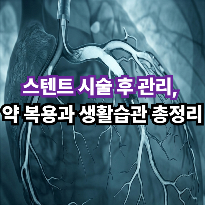 스텐트 시술 후 관리, 약 복용과 생활습관 총정리