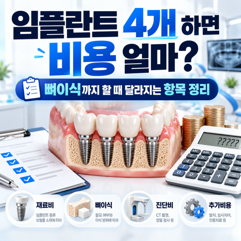 임플란트 4개 하면 비용 얼마? 뼈이식까지 할 때 달라지는 항목 정리