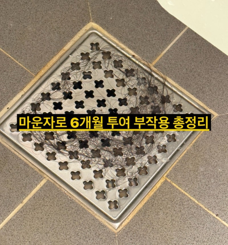 마운자로 요요 부작용 이틀만에 3.4kg 증가 10mg 투여후기