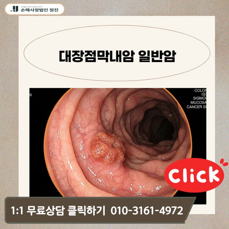 대장점막내암 일반암 진단비, D01 코드인데 전액 받을 수 있을까요?