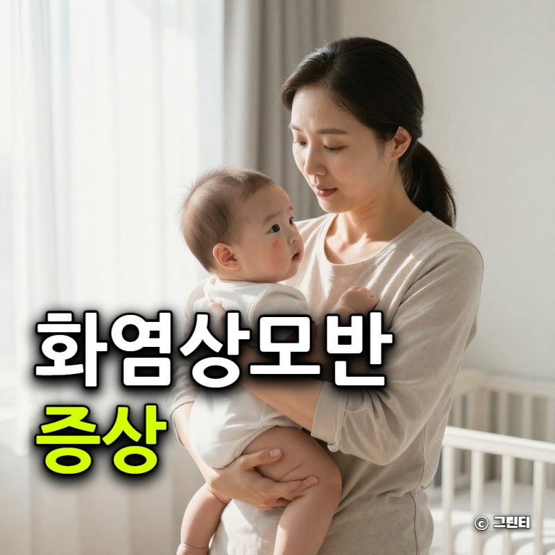 화염상모반 증상, 단순 붉은 반점과 구별법