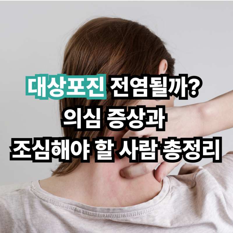 대상포진 전염될까? 의심 증상과 조심해야 할 사람 총정리