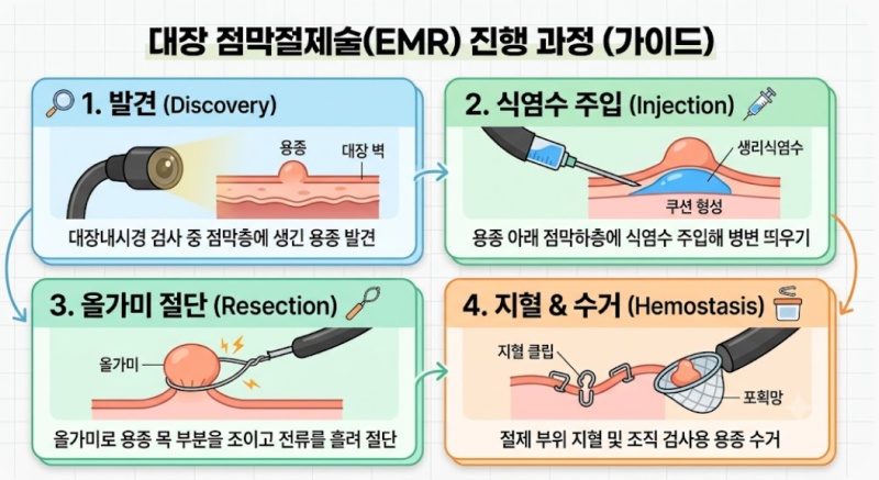 대장용종 3개 제거 후기｜EMR로 용종 제거하고 온 날, 검사 결과와 식사·주의사항
