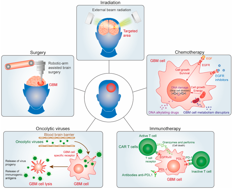 뇌종양 Brain tumor: 뇌종양 의료진·의료기관·연구 확인 링크 디렉토리 2026