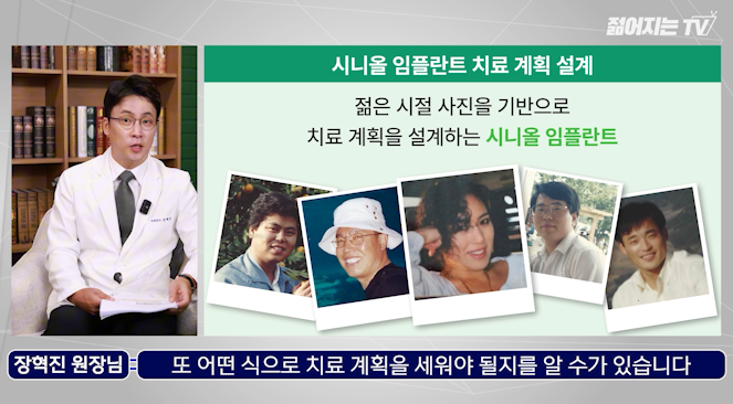 무치악임플란트비용, 전체임플란트 치료 전 꼭 확인해야 할 사항