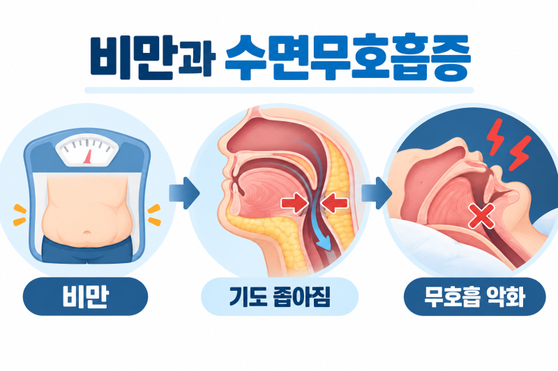 다이어트 주사로만 아셨나요? 마운자로 실비, 수면무호흡증이라면 달라집니다.