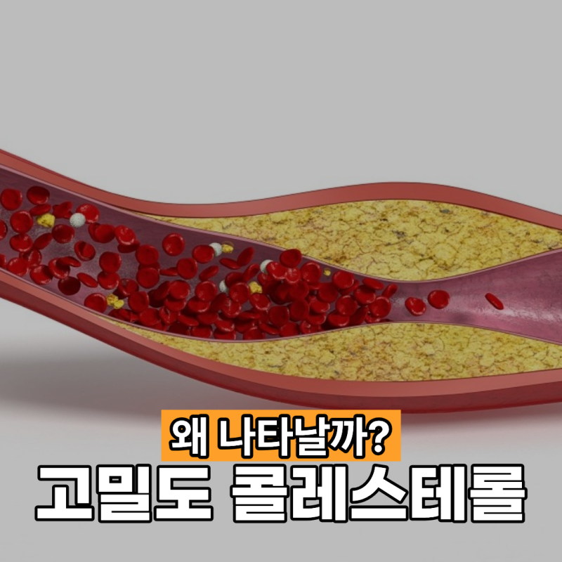 고밀도 콜레스테롤 나타나는 이유