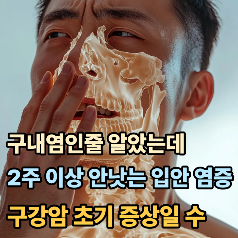 그냥 구내염인 줄 알았는데…” 2주 넘게 안 낫는 입안 염증, 구강암 초기증상일 수