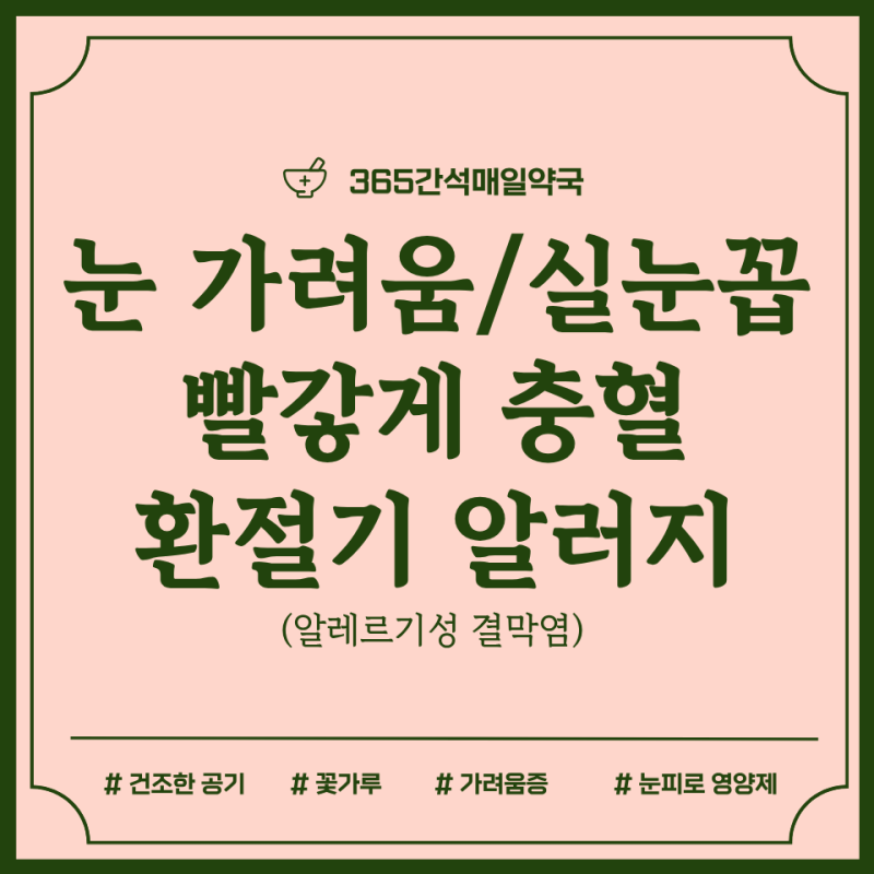 환절기 눈 가려움·실눈곱·충혈! 약국 알레르기 안약 4종 비교