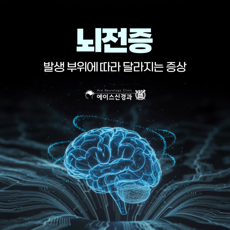 뇌전증 증상 유형에 따른 치료 경과와 뇌전증 예후