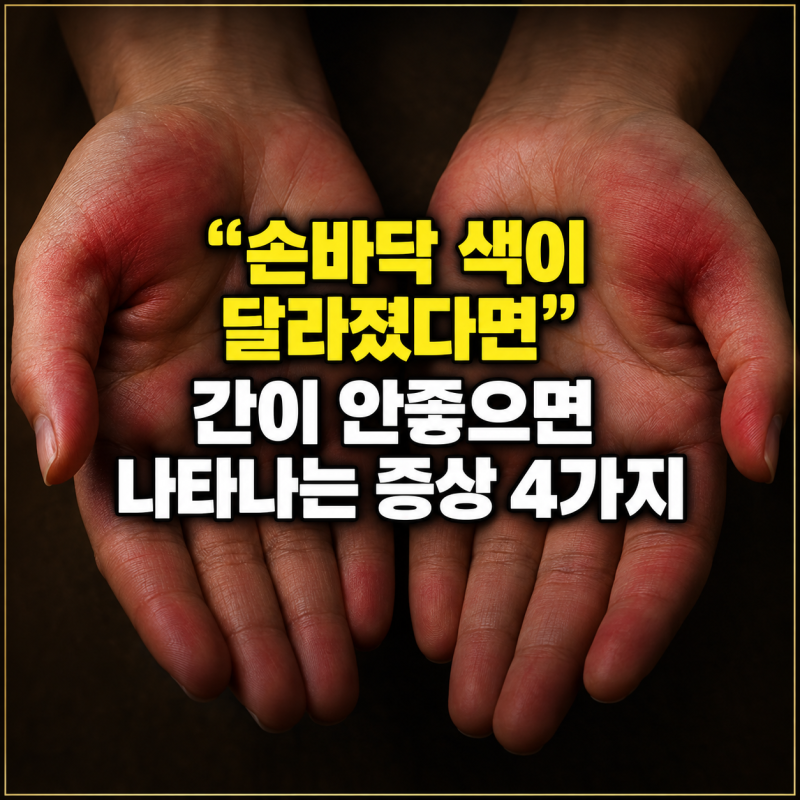"손바닥 색이 달라졌다면" 간이 안좋으면 나타나는 증상 4가지