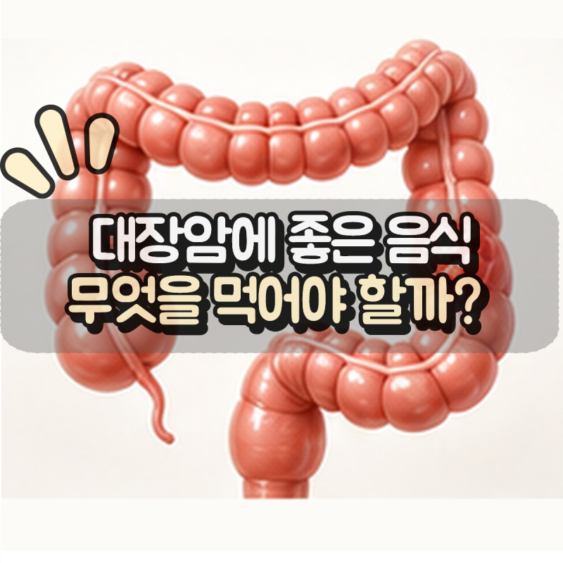 “대장암에 좋은 음식, 뭘 먹어야 할까?” 식탁에서 챙겨볼 음식 5가지