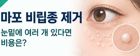 마포 비립종 제거, 눈밑에 여러 개 있다면 비용은 어떻게 볼까요?