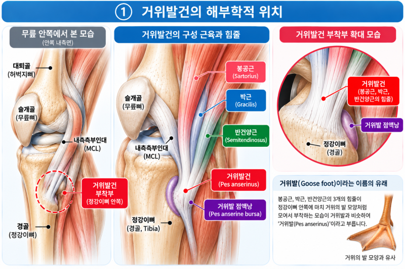 거위발건염