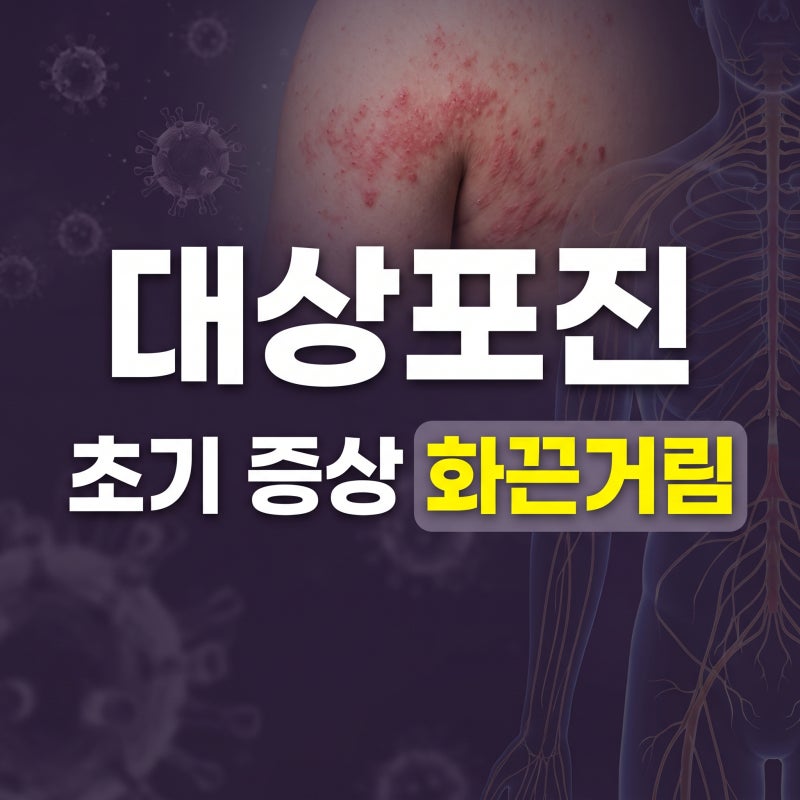 20대도 안심할수 없는 대상포진 초기증상 원인 전염성 감염(+치료골든타임 관리법)