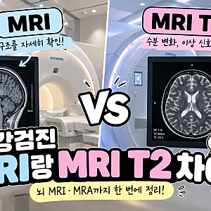 건강검진 MRI랑 MRI T2 차이 뭘까? 뇌 MRI·MRA까지 쉽게 정리