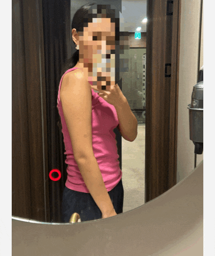 [강남 다이어트주사 후기] 마운자로 단약 후 다이어트약 처방과 함께한 지방분해주사 팔뚝살....