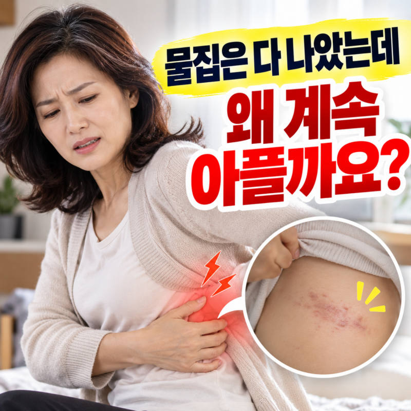 "대상포진 물집은 다 나았는데 계속 아파요" 대상포진 후 신경통일까요?｜전주 두사랑 신경....