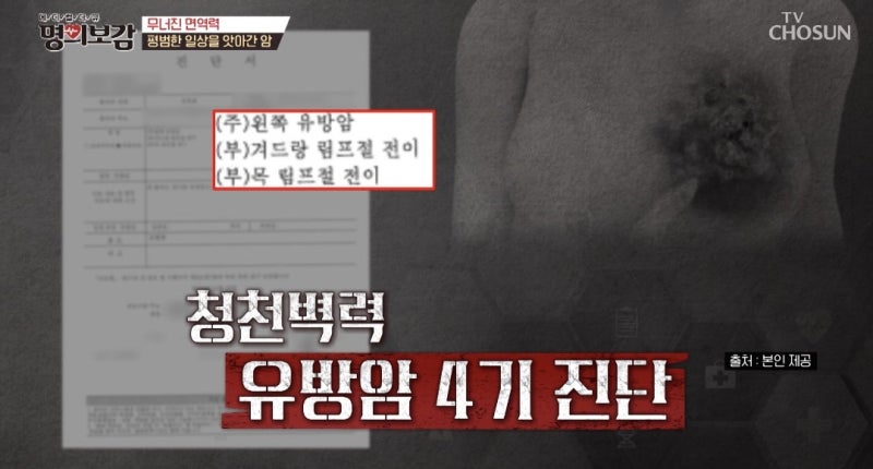 단순한 피로인 줄 알았는데…유방암 4기 진단, 그녀에게 나타난 몸의 변화