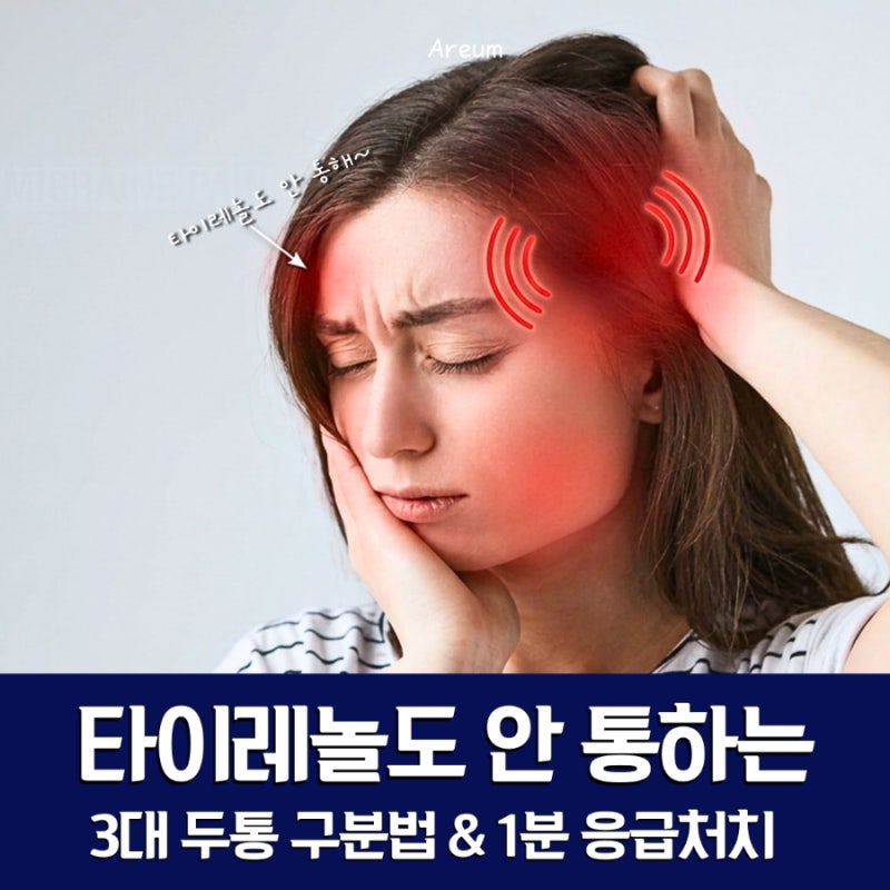 편두통 타이레놀 안 통할 때, 3대 두통 구분법과 1분 응급처치