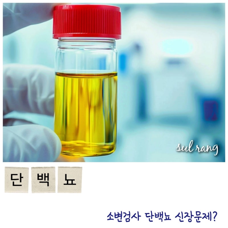 소변검사, 단백뇨가 나오면 신장문제?