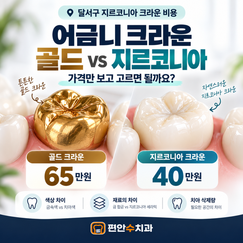 [달서구 지르코니아 크라운 비용] 어금니 씌우는 가격 골드·지르코니아 무엇이 다를까요?