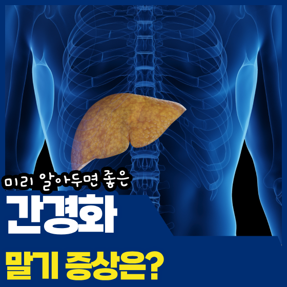 간경화 말기 증상, 배가 붓고 정신이 흐려진다면 어떤 상태일까요?