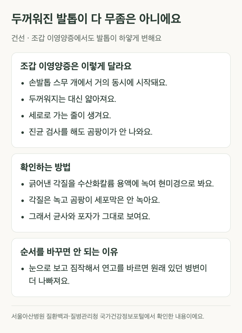 내성발톱 발톱무좀 차이, 엄지발톱이 아프면 어느 쪽일까?