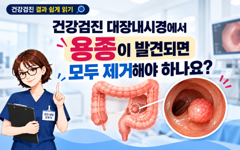 건강검진 대장내시경에서 용종이 발견되면 모두 제거해야 하나요?