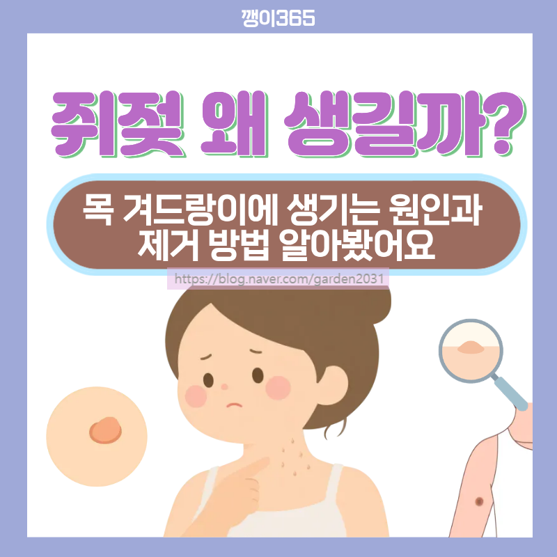 쥐젖 왜 생길까? 목 겨드랑이에 생기는 원인과 제거 방법 알아봤어요