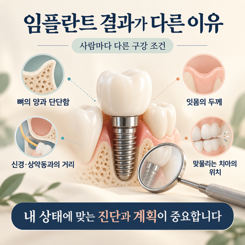 화원 치과 임플란트 수술, 꼭 알아야 할 중요한 것들
