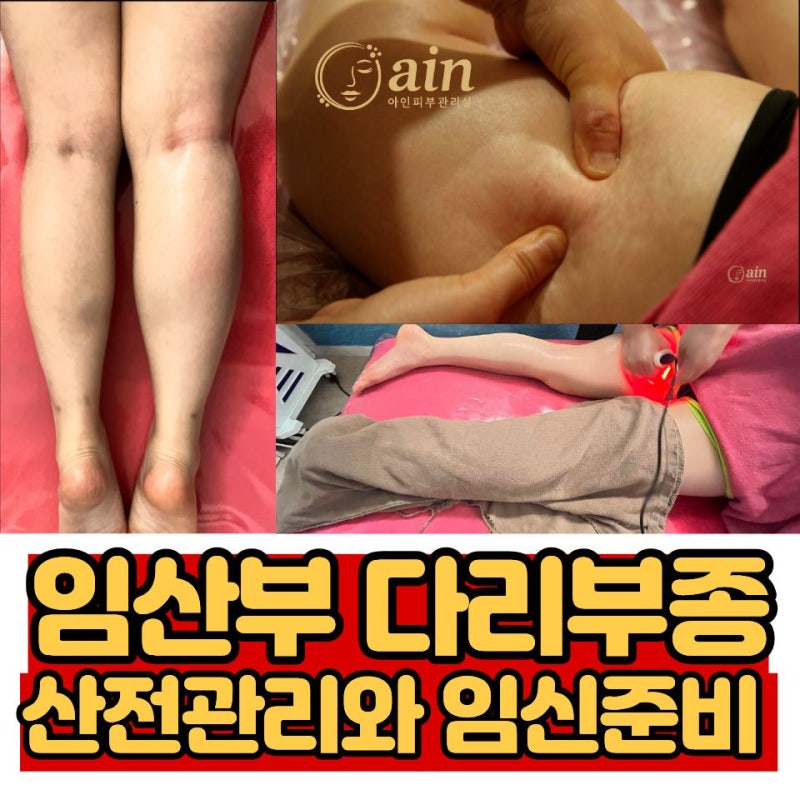 천안 산전관리, 임산부 다리부종· 임신준비 산전마사지 어떻게 받으면 좋을까?