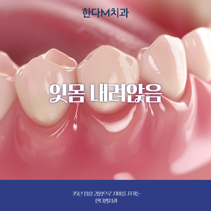 잇몸 내려앉음, 원인부터 치료 방법까지 알려드립니다
