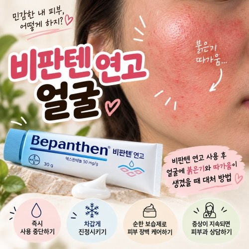 비판텐 연고 사용 후 얼굴에 붉은기와 따가움이 생겼을 때 대처 방법