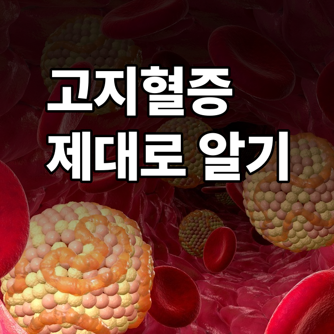 고지혈증, 원인도 증상도 모른 채 수치만 보고 놀라셨다면