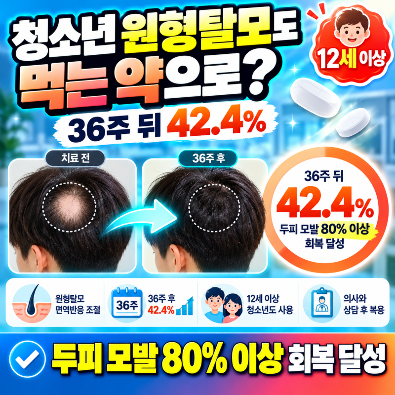 청소년 원형탈모, 이제 먹는 약으로? 올루미언트 36주 효과 확인해보니