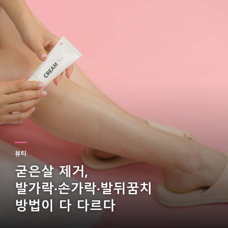 굳은살 제거, 발가락·손가락·발뒤꿈치 방법이 다 다르다