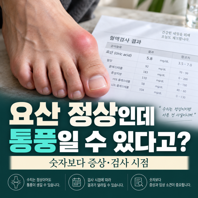 통풍 초기증상, 요산 정상인데 엄지발가락이 붓는다면?