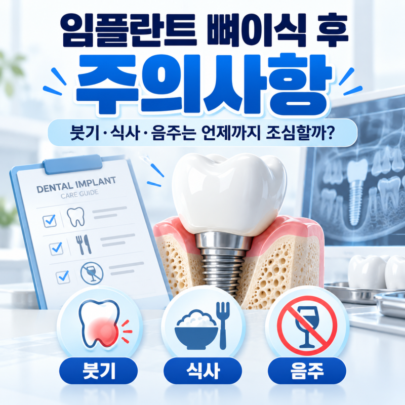 임플란트 뼈이식 후 주의사항, 붓기·식사·음주는 언제까지 조심할까?