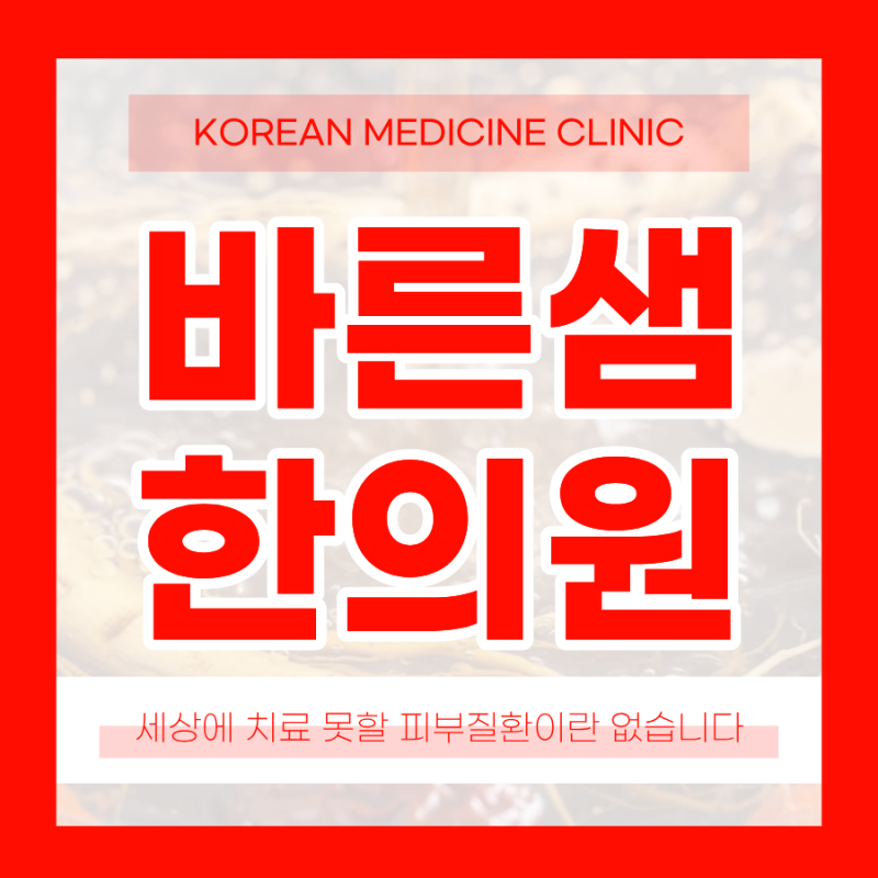 안면지루성피부염, 이마와 턱 주변으로 염증이 번지는 이유는 무엇일까?