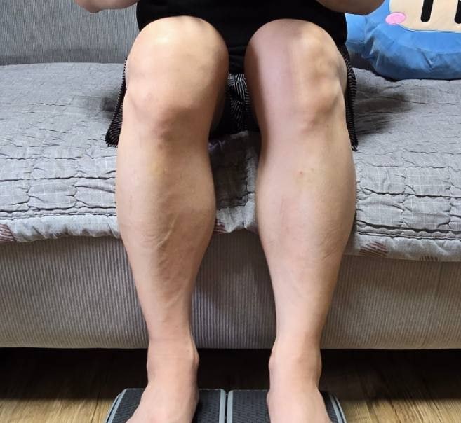 콘드로이친zs 후기 / 중년 관절염 극복 경험담