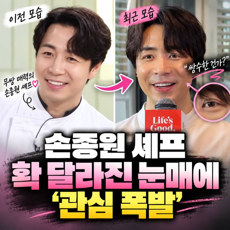 손종원 셰프 오랜만에 등장했는데 눈매가 달라졌다, “쌍수한 건가?”