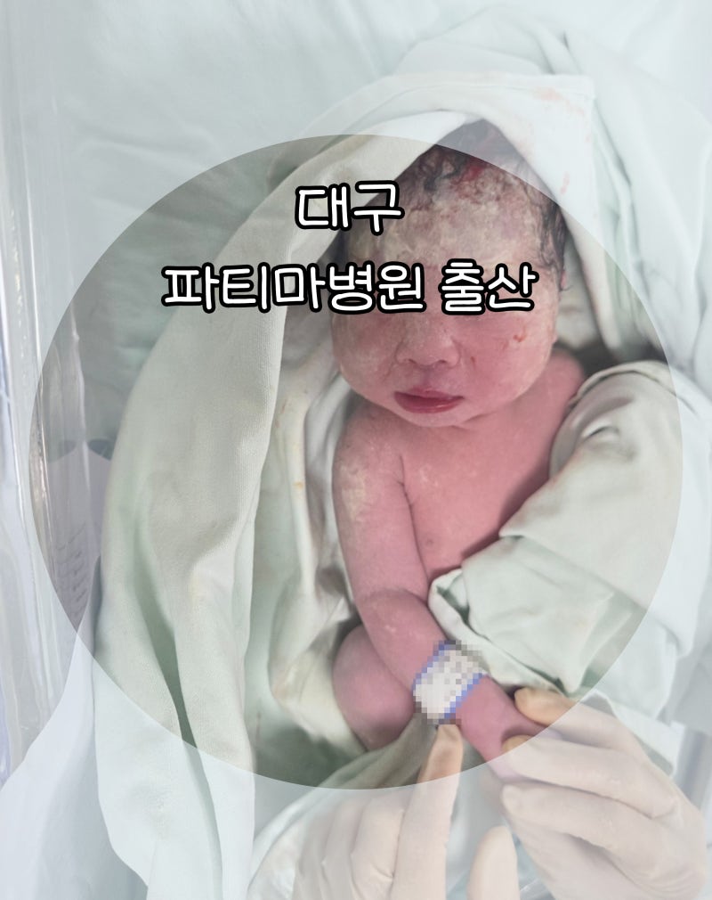 26.7.1 1694DAY 대구파티마병원 질식분만 출산